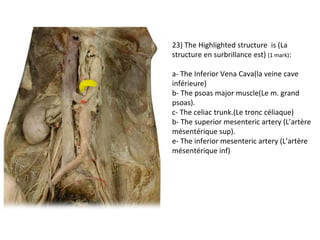 23) The Highlighted structure is (La 
structure en surbrillance est) (1 mark): 
a- The Inferior Vena Cava(la veine cave 
inférieure) 
b- The psoas major muscle(Le m. grand 
psoas). 
c- The celiac trunk.(Le tronc céliaque) 
b- The superior mesenteric artery (L’artère 
mésentérique sup). 
e- The inferior mesenteric artery (L’artère 
mésentérique inf) 
 