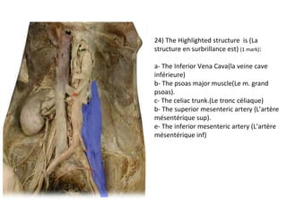24) The Highlighted structure is (La 
structure en surbrillance est) (1 mark): 
a- The Inferior Vena Cava(la veine cave 
inférieure) 
b- The psoas major muscle(Le m. grand 
psoas). 
c- The celiac trunk.(Le tronc céliaque) 
b- The superior mesenteric artery (L’artère 
mésentérique sup). 
e- The inferior mesenteric artery (L’artère 
mésentérique inf) 
 