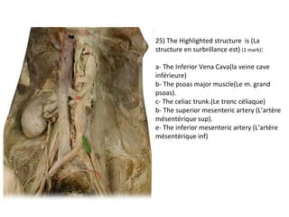 25) The Highlighted structure is (La 
structure en surbrillance est) (1 mark): 
a- The Inferior Vena Cava(la veine cave 
inférieure) 
b- The psoas major muscle(Le m. grand 
psoas). 
c- The celiac trunk.(Le tronc céliaque) 
b- The superior mesenteric artery (L’artère 
mésentérique sup). 
e- The inferior mesenteric artery (L’artère 
mésentérique inf) 
 