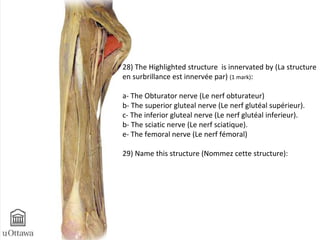 28) The Highlighted structure is innervated by (La structure 
en surbrillance est innervée par) (1 mark): 
a- The Obturator nerve (Le nerf obturateur) 
b- The superior gluteal nerve (Le nerf glutéal supérieur). 
c- The inferior gluteal nerve (Le nerf glutéal inferieur). 
b- The sciatic nerve (Le nerf sciatique). 
e- The femoral nerve (Le nerf fémoral) 
29) Name this structure (Nommez cette structure): 
 