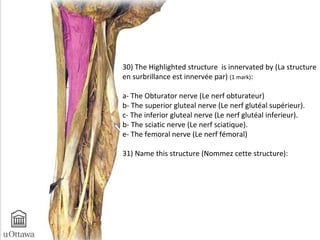 30) The Highlighted structure is innervated by (La structure 
en surbrillance est innervée par) (1 mark): 
a- The Obturator nerve (Le nerf obturateur) 
b- The superior gluteal nerve (Le nerf glutéal supérieur). 
c- The inferior gluteal nerve (Le nerf glutéal inferieur). 
b- The sciatic nerve (Le nerf sciatique). 
e- The femoral nerve (Le nerf fémoral) 
31) Name this structure (Nommez cette structure): 
 