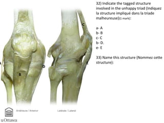 E 
D 
C 
B 
A 
32) Indicate the tagged structure 
involved in the unhappy triad (Indiquez 
la structure impliqué dans la triade 
malheureuse)(1 mark): 
a- A 
b- B 
c- C 
b- D. 
e- E 
33) Name this structure (Nommez cette 
structure): 
 