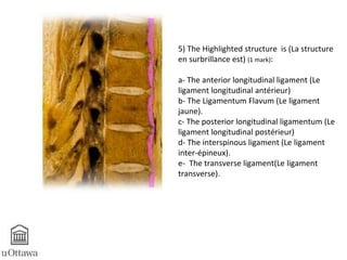 5) The Highlighted structure is (La structure 
en surbrillance est) (1 mark): 
a- The anterior longitudinal ligament (Le 
ligament longitudinal antérieur) 
b- The Ligamentum Flavum (Le ligament 
jaune). 
c- The posterior longitudinal ligamentum (Le 
ligament longitudinal postérieur) 
d- The interspinous ligament (Le ligament 
inter-épineux). 
e- The transverse ligament(Le ligament 
transverse). 
 