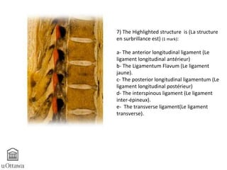 7) The Highlighted structure is (La structure 
en surbrillance est) (1 mark): 
a- The anterior longitudinal ligament (Le 
ligament longitudinal antérieur) 
b- The Ligamentum Flavum (Le ligament 
jaune). 
c- The posterior longitudinal ligamentum (Le 
ligament longitudinal postérieur) 
d- The interspinous ligament (Le ligament 
inter-épineux). 
e- The transverse ligament(Le ligament 
transverse). 
 
