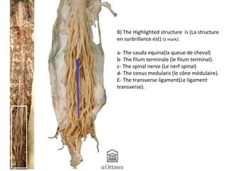 1 
5 
4 
3 
2 
8) The Highlighted structure is (La structure 
en surbrillance est) (1 mark): 
a- The cauda equina(la queue de cheval) 
b- The filum terminale (le filum terminal). 
c- The spinal nerve (Le nerf spinal) 
d- The conus medularis (le cône médulaire). 
E- The transverse ligament(Le ligament 
transverse). 
 