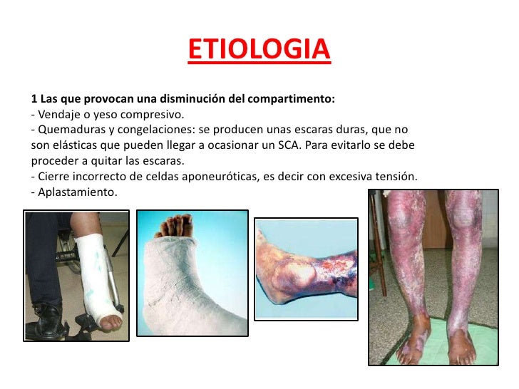 Que ejercicios es necesario para el aumento del miembro