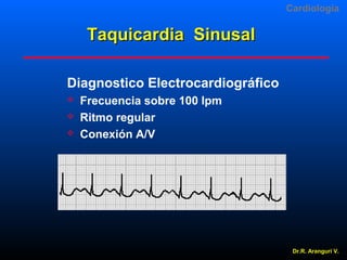 Cardiologia

Taquicardia Sinusal
Diagnostico Electrocardiográfico




Frecuencia sobre 100 lpm
Ritmo regular
Conexión A/V

Dr.R. Arangurí V.

 