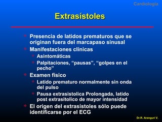 Cardiologia

Extrasístoles




Presencia de latidos prematuros que se
originan fuera del marcapaso sinusal
Manifestaciones clínicas





Examen físico






Asintomáticas
Palpitaciones, “pausas”, “golpes en el
pecho”
Latido prematuro normalmente sin onda
del pulso
Pausa extrasistolica Prolongada, latido
post extrasitolico de mayor intensidad

El origen del extrasístoles sólo puede
identificarse por el ECG
Dr.R. Arangurí V.

 