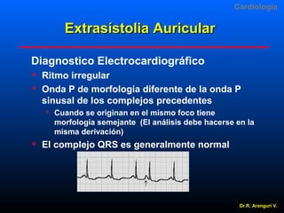 Cardiologia

Extrasístolia Auricular
Diagnostico Electrocardiográfico



Ritmo irregular
Onda P de morfología diferente de la onda P
sinusal de los complejos precedentes




Cuando se originan en el mismo foco tiene
morfologia semejante (El análisis debe hacerse en la
misma derivación)

El complejo QRS es generalmente normal

Dr.R. Arangurí V.

 