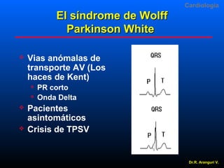 Cardiologia

El síndrome de Wolff
Parkinson White


Vias anómalas de
transporte AV (Los
haces de Kent)







PR corto
Onda Delta

Pacientes
asintomáticos
Crisis de TPSV

Dr.R. Arangurí V.

 
