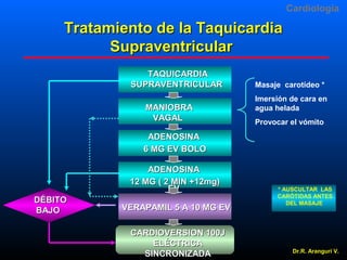 Cardiologia

Tratamiento de la Taquicardia
Supraventricular
TAQUICARDIA
SUPRAVENTRICULAR
MANIOBRA
VAGAL

Masaje carotídeo *
Imersión de cara en
agua helada
Provocar el vómito

ADENOSINA
6 MG EV BOLO
ADENOSINA
12 MG ( 2 MIN +12mg)
EV
DÉBITO
BAJO

VERAPAMIL 5 A 10 MG EV
CARDIOVERSION 100J
ELÉCTRICA
SINCRONIZADA

* AUSCULTAR LAS
CARÓTIDAS ANTES
DEL MASAJE

Dr.R. Arangurí V.

 