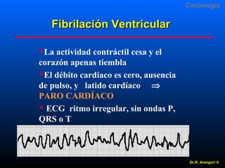 Cardiologia

Fibrilación Ventricular
La

actividad contráctil cesa y el
corazón apenas tiembla
El débito cardíaco es cero, ausencia
de pulso, y latido cardíaco ⇒
PARO CARDÍACO
 ECG ritmo irregular, sin ondas P,
QRS o T

Dr.R. Arangurí V.

 
