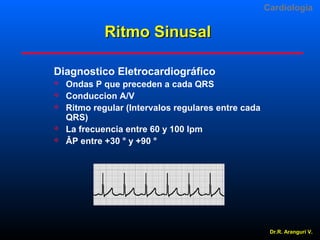 Cardiologia

Ritmo Sinusal
Diagnostico Eletrocardiográfico







Ondas P que preceden a cada QRS
Conduccion A/V
Ritmo regular (Intervalos regulares entre cada
QRS)
La frecuencia entre 60 y 100 lpm
ÂP entre +30 ° y +90 °

Dr.R. Arangurí V.

 