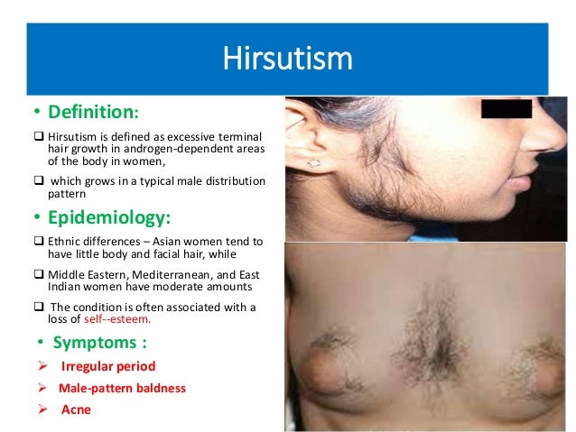 hair diseases