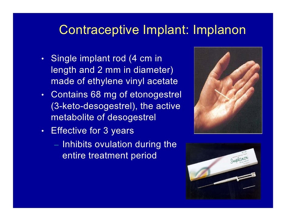 Contraception And Hiv