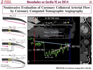 Choi et al. Circ Cardiovasc Imaging 2014; 7:482-490
 