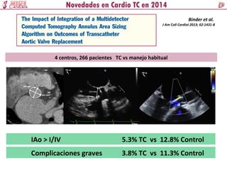 Binder et al.
J Am Coll Cardiol 2013; 62:1431-8
4 centros, 266 pacientes TC vs manejo habitual
IAo > I/IV 5.3% TC vs 12.8% Control
Complicaciones graves 3.8% TC vs 11.3% Control
 