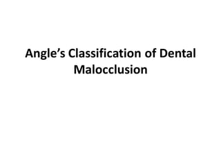 Angle’s Classification of Dental
Malocclusion
 