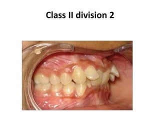 Class II division 2
 
