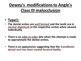 Dewey's modifications to Angle's
Class III malocclusion
• Type1:
• The dental arches are well formed and the teeth are in
normal alignment in the respective arches when viewed
individually.
• There is an edge-to-edge bite when the attempt is made
to approximate the dental arches,
• There is an appearance suggesting that the mandibular
dental arch has been moved forward bodily.
 