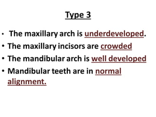 Type 3
• The maxillary arch is underdeveloped.
• The maxillary incisors are crowded
• The mandibular arch is well developed
• Mandibular teeth are in normal
alignment.
 