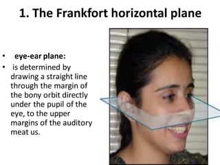 1. The Frankfort horizontal plane
• eye-ear plane:
• is determined by
drawing a straight line
through the margin of
the bony orbit directly
under the pupil of the
eye, to the upper
margins of the auditory
meat us.
 