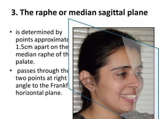 3. The raphe or median sagittal plane
• is determined by
points approximately
1.5cm apart on the
median raphe of the
palate.
• passes through these
two points at right
angle to the Frankfort
horizontal plane.
 
