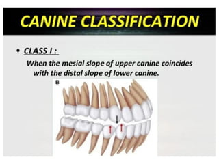 update Classification of Malocclusion- updated.pdf