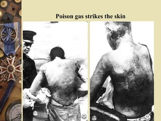 British troops and cavalry went “over the top” Shear numbers allow attack to be “successful” First day of battle 60,000 British soldiers killed British general believed he had to attack - used old tactics in new war 420,000 British; 200,000 French; 500,000 Germans killed Battle of Somme 