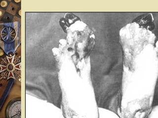 The Somme – July, 1916 60,000 British soldiers killed in one day. Over 1,000,000 killed in 5 months. 