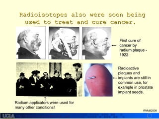 http://dmco.ucla.edu/McBride_Labhttp://dmco.ucla.edu/McBride_Lab
WMcB2008
Radioisotopes also were soon beingRadioisotopes also were soon being
used to treat and cure cancer.used to treat and cure cancer.
Radium applicators were used for
many other conditions!
Radioactive
plaques and
implants are still in
common use, for
example in prostate
implant seeds.
First cure ofFirst cure of
cancer bycancer by
radium plaque -radium plaque -
19221922
 