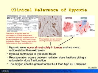 http://dmco.ucla.edu/McBride_Labhttp://dmco.ucla.edu/McBride_Lab
WMcB2008
• Hypoxic areasHypoxic areas occur almost solely in tumorsoccur almost solely in tumors and are moreand are more
radioresistant than oxic areas.radioresistant than oxic areas.
• Hypoxia contributes to treatment failureHypoxia contributes to treatment failure
• Reoxygenation occurs between radiation dose fractions giving aReoxygenation occurs between radiation dose fractions giving a
rationale for dose fractionationrationale for dose fractionation
• The oxygen effect is greater for low LET than high LET radiationThe oxygen effect is greater for low LET than high LET radiation
Giacca and Brown
Pimonizadole (oxygen mimetic)
staining colorectal carcinoma
The effects of hypoxia were first
discovered in 1909 by Schwarz who
showed that strapping a radium source on
the arm gave less of a skin reaction than
just placing it there. This was used to give
higher doses to deep seated tumors.
Clinical Relevance of HypoxiaClinical Relevance of Hypoxia
 