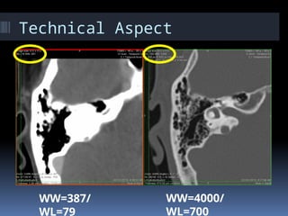 Temporal Scan UPDATED TEMPORAL IMAGING SCANS 2019.pptx