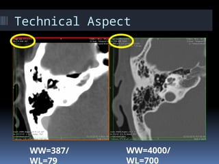 Temporal Scan UPDATED TEMPORAL IMAGING SCANS 2019.pptx