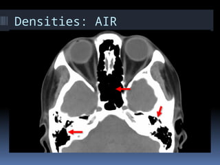 Temporal Scan UPDATED TEMPORAL IMAGING SCANS 2019.pptx