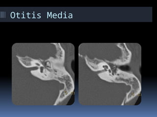 Temporal Scan UPDATED TEMPORAL IMAGING SCANS 2019.pptx