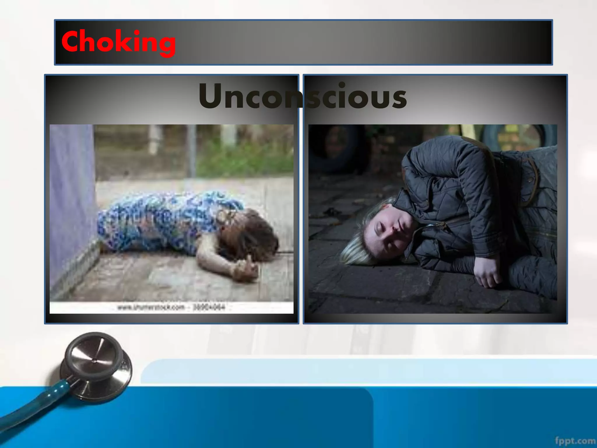 Choking
Unconscious
 