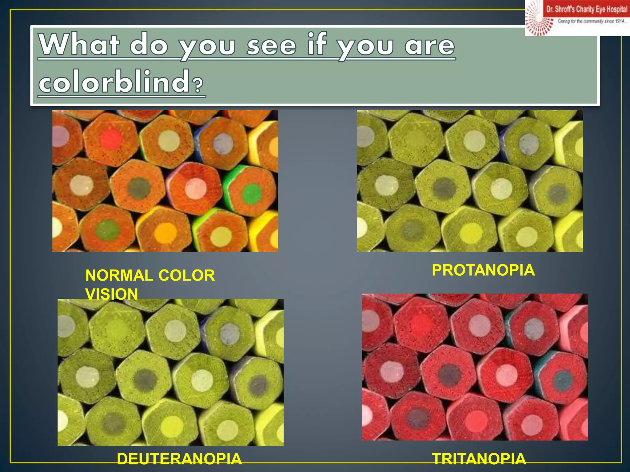 NORMAL COLOR
VISION
PROTANOPIA
DEUTERANOPIA TRITANOPIA
 