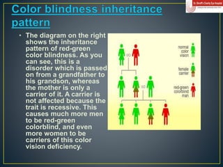 color vision.ppt