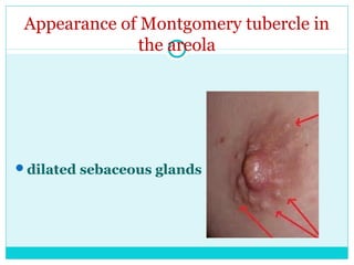 diagnosis-of-pregnancy-antenatal-care-for-undergraduate-ppt