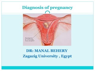Diagnosis of pregnancy




 DR: MANAL BEHERY
Zagazig University , Egypt
 