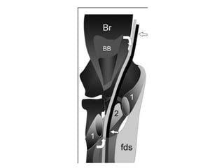 Updated Elbow Musculoskeletal US Examination | PPTX
