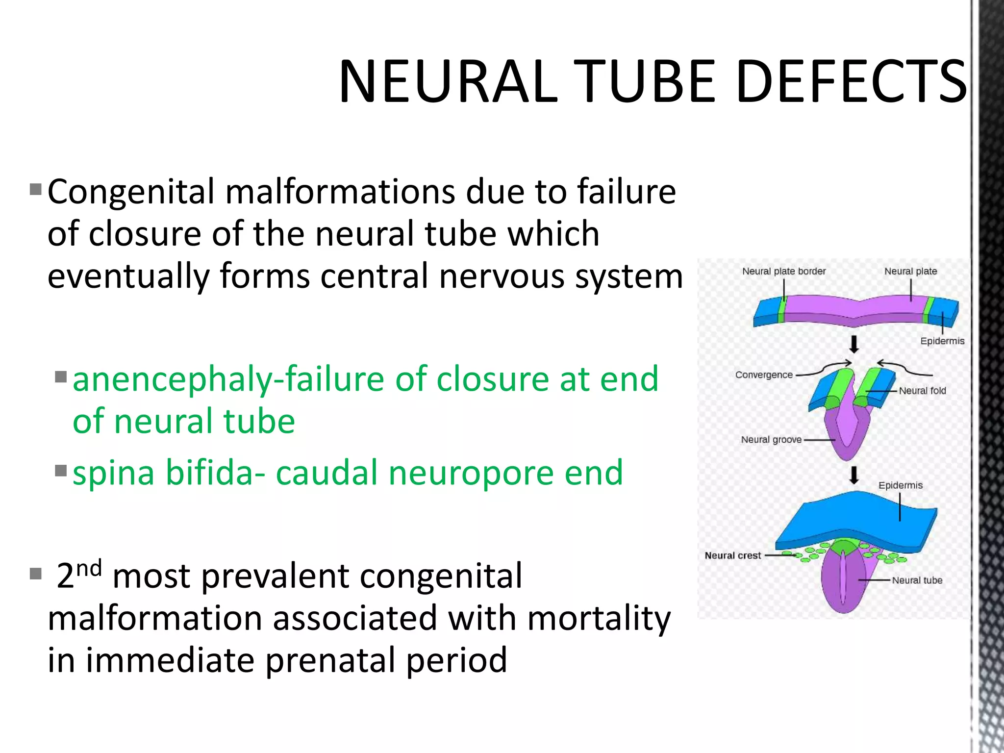 Congenital malformations due to failure
of closure of the neural tube which
eventually forms central nervous system
anencephaly-failure of closure at end
of neural tube
spina bifida- caudal neuropore end
 2nd most prevalent congenital
malformation associated with mortality
in immediate prenatal period
 