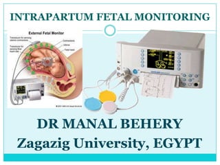 INTRAPARTUM FETAL MONITORING




   DR MANAL BEHERY
 Zagazig University, EGYPT
 