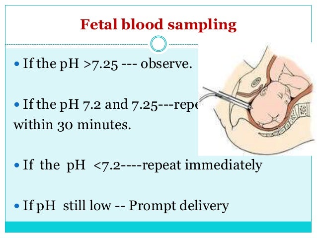 intrapartum fetal monitoring for undergraduate