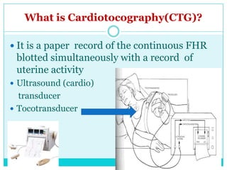 Updated intrapartum fetal monitoring | PPTX