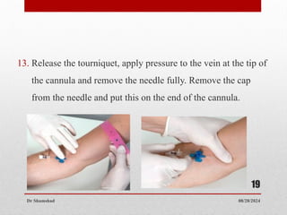 08/28/2024
Dr Shamshad
19
13. Release the tourniquet, apply pressure to the vein at the tip of
the cannula and remove the needle fully. Remove the cap
from the needle and put this on the end of the cannula.
 