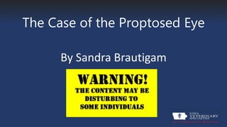 The Case of the Proptosed Eye
By Sandra Brautigam
 