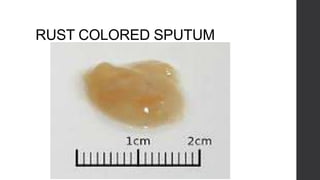 RUST COLORED SPUTUM
 