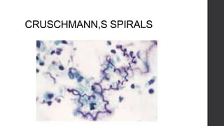 CRUSCHMANN,S SPIRALS
 